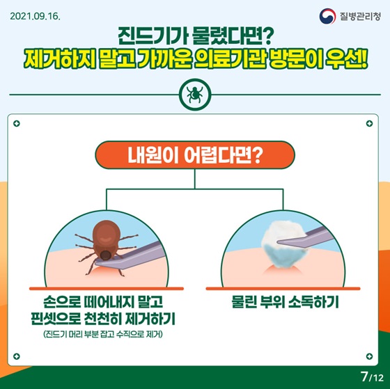 ◆ 진드기가 물렸다면? 제거하지 말고 가까운 의료기관 방문이 우선!
- 내원이 어렵다면?
• 손으로 떼어내지 말고 핀셋으로 천천히 제거하기(진드기 머리 부분 잡고 수직으로 제거)
• 물린 부위 소독하기